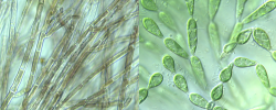 rhodophytes